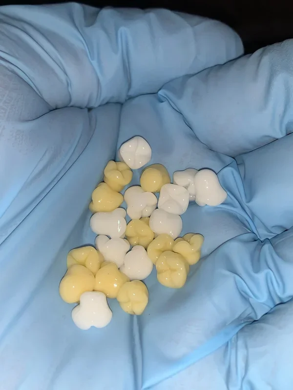 FrostysFresh Terp Teeth ?